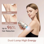 Load image into Gallery viewer, Dreame Nova IPL Hair Removal Device
