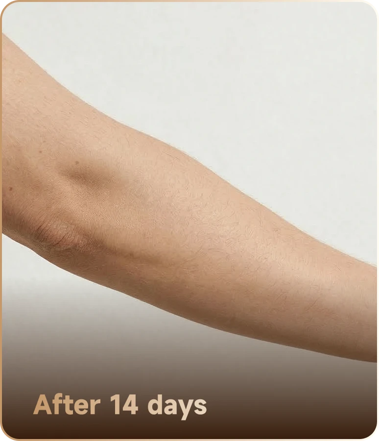 After 14 days