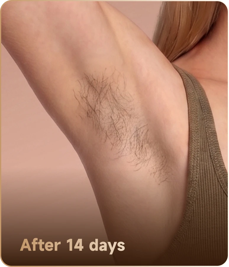 After 14 days