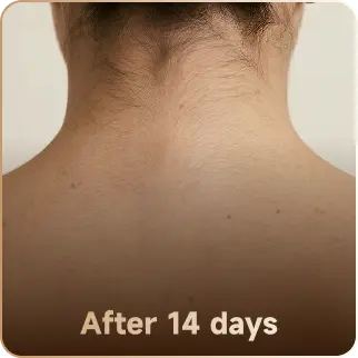 After 14 days