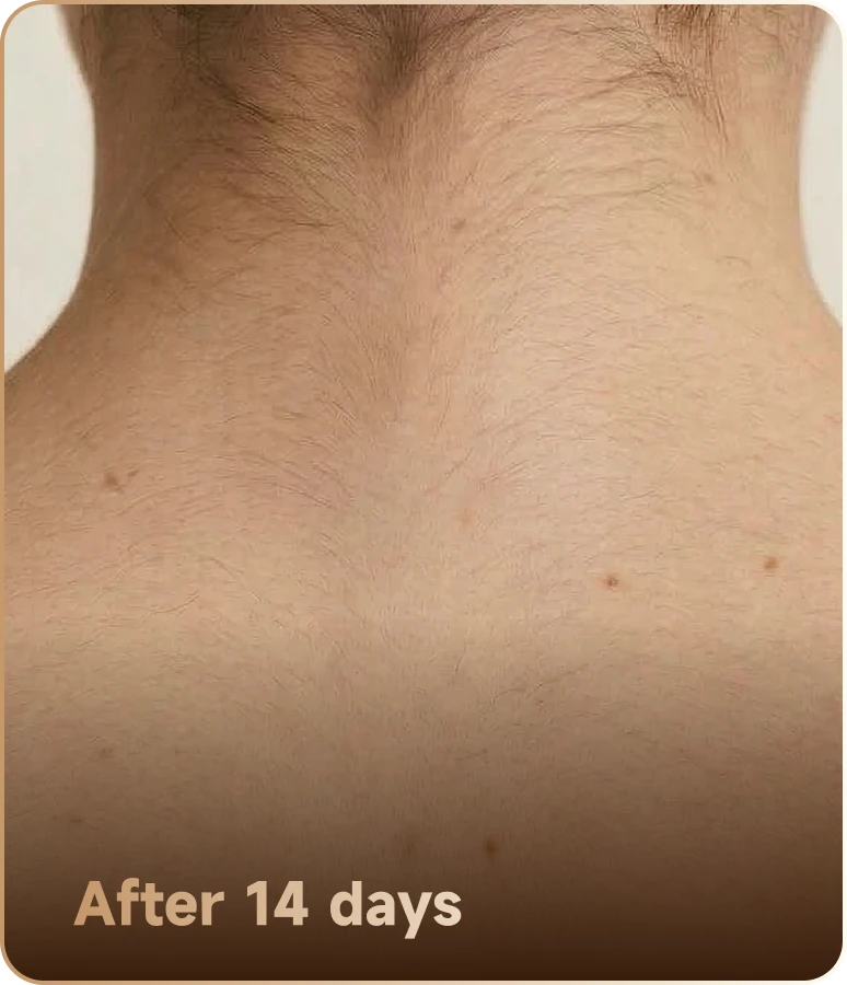 After 14 days
